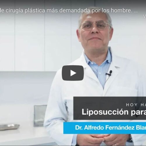 Liposucción para hombres