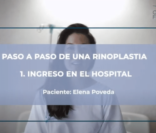 Paso a paso de una rinoplastia