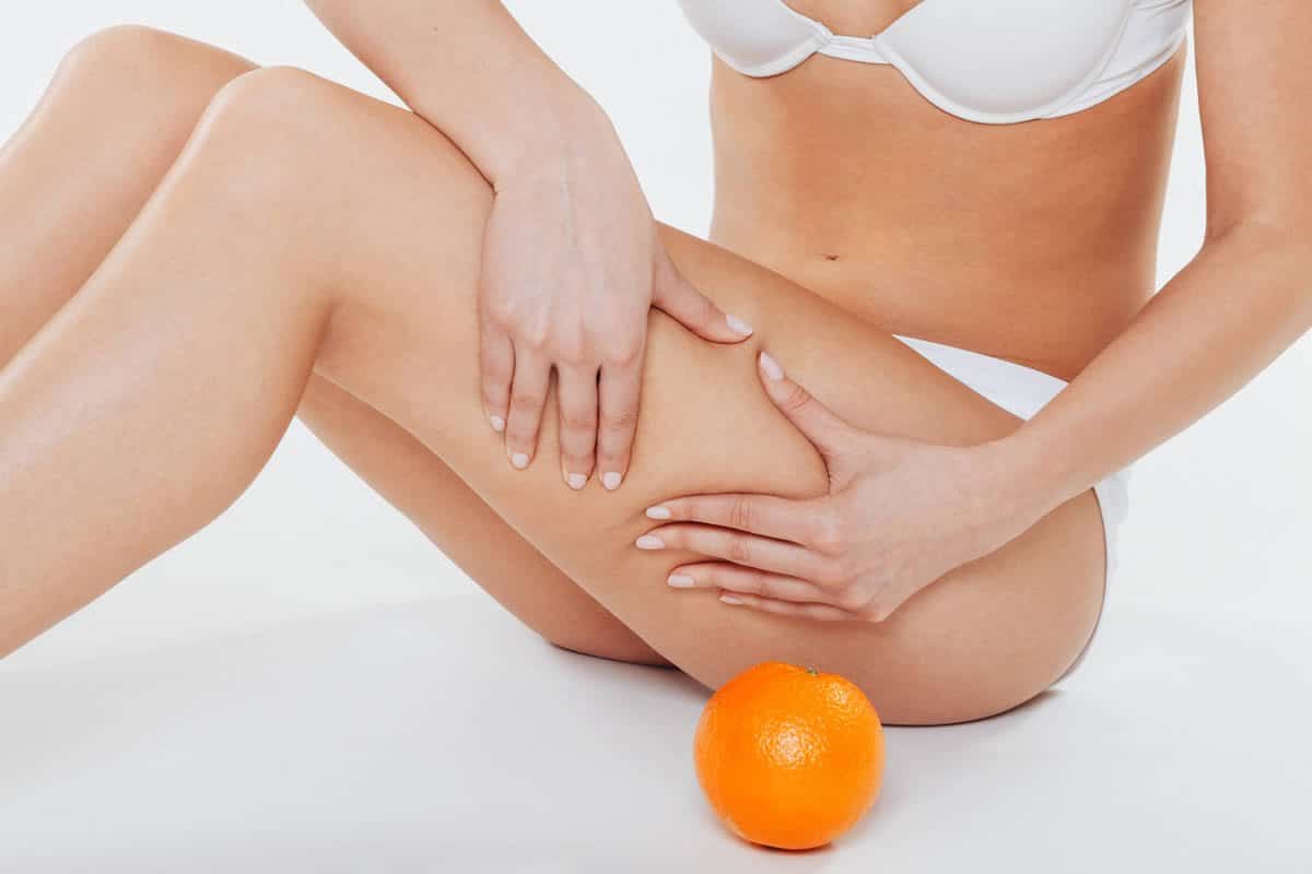 Eliminar la celulitis con Liposucción y otros tratamientos estéticos