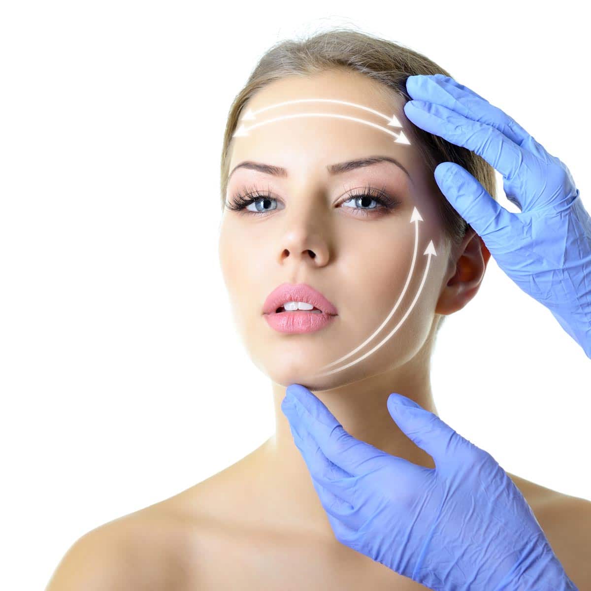 Lifting facial con hilos tensores: rejuvenecer sin intervención quirúrgica