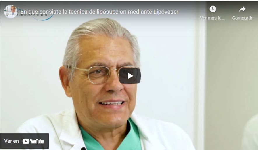 En qué consiste la técnica de liposucción mediante Lipovaser