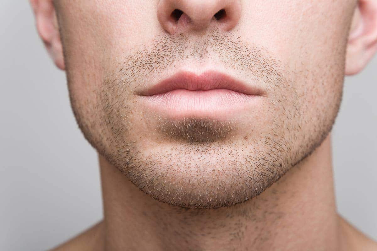 Mentoplastia y Prótesis de Gonión: Cirugías para el rostro masculino